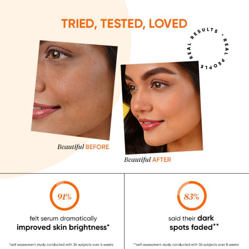 Dot & Key 10% Vitamin C + E & 5% Niacinamide Glowing Face Serum- Fights Pigmentation & Dark Spots (30ml)