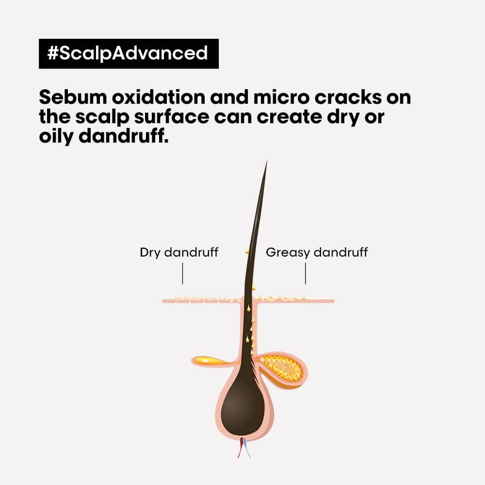 LOreal Scalp Advanced Anti-Dandruff Dermo-Clarifier Shampoo